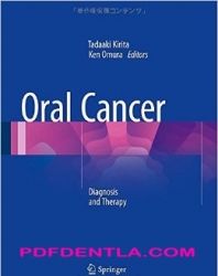 Oral Cancer: Diagnosis and Therapy (pdf)
